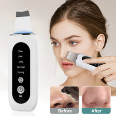 Ultrasonic Skin Scrubber Blackhead Remover Deep Face Cleaning